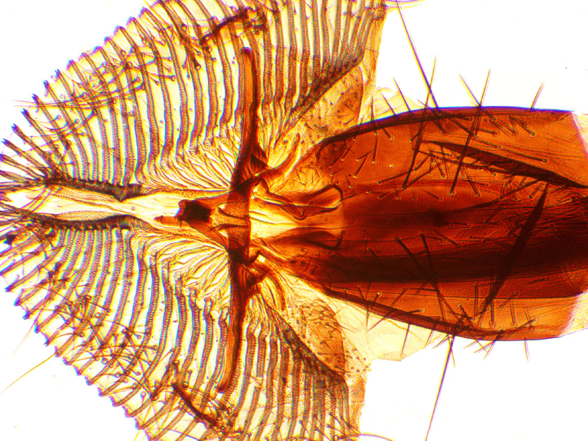 Two inch objective View of Proboscis of Blowfly