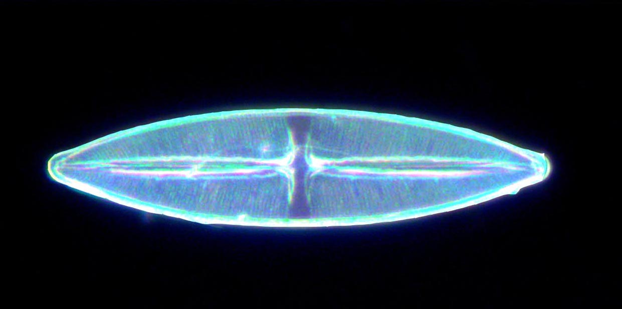dark ground diatom