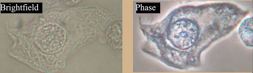 brightfield and phase contrast compared
