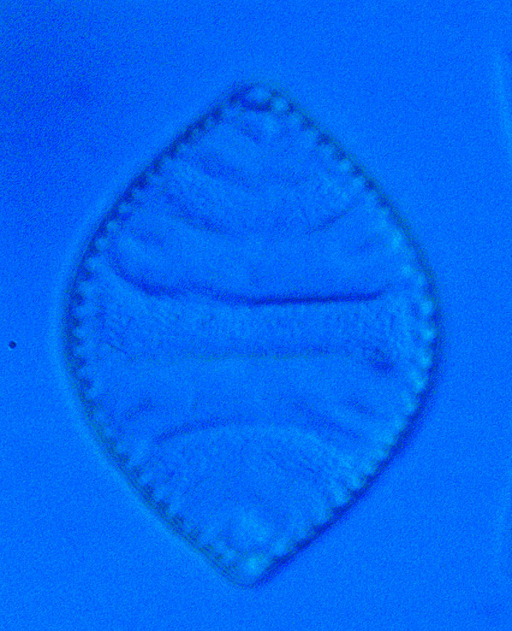 diatom