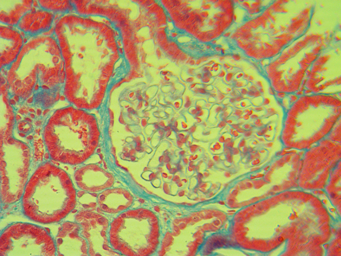 kidney 20X objective