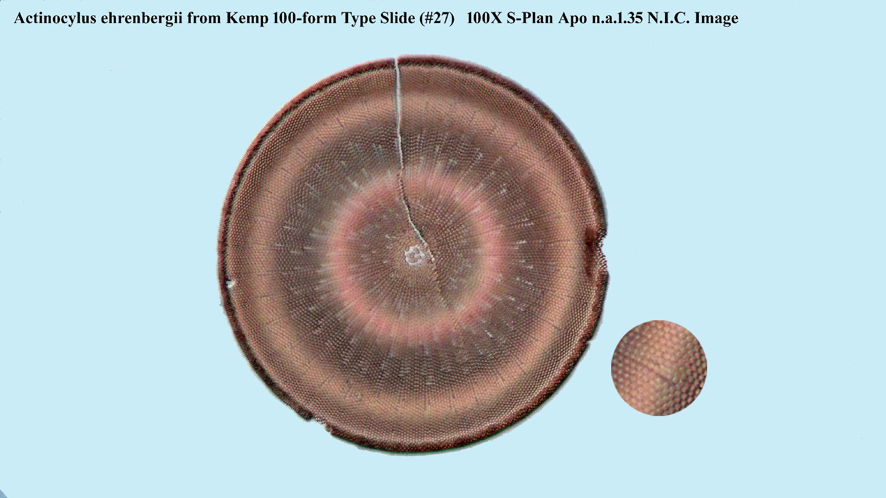 A ehrenbergii (octanarius)