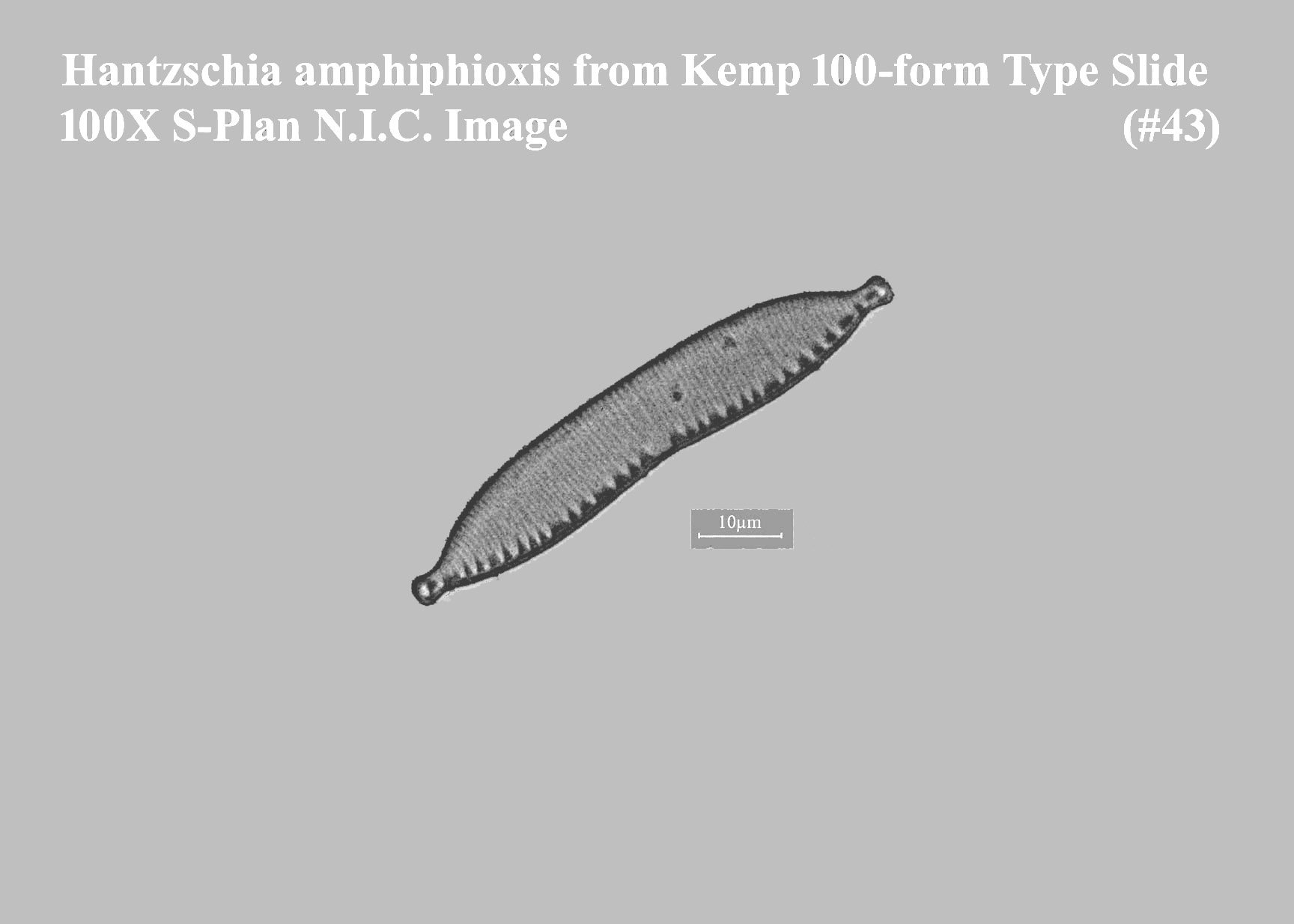 Hantzschia amphioxis