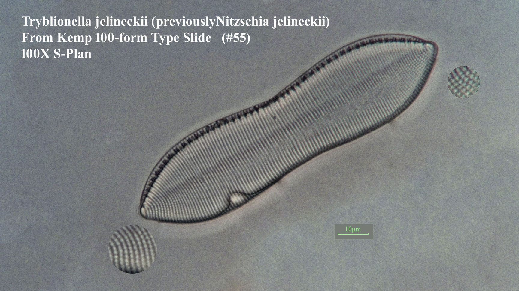 Nitschia jelenineckii