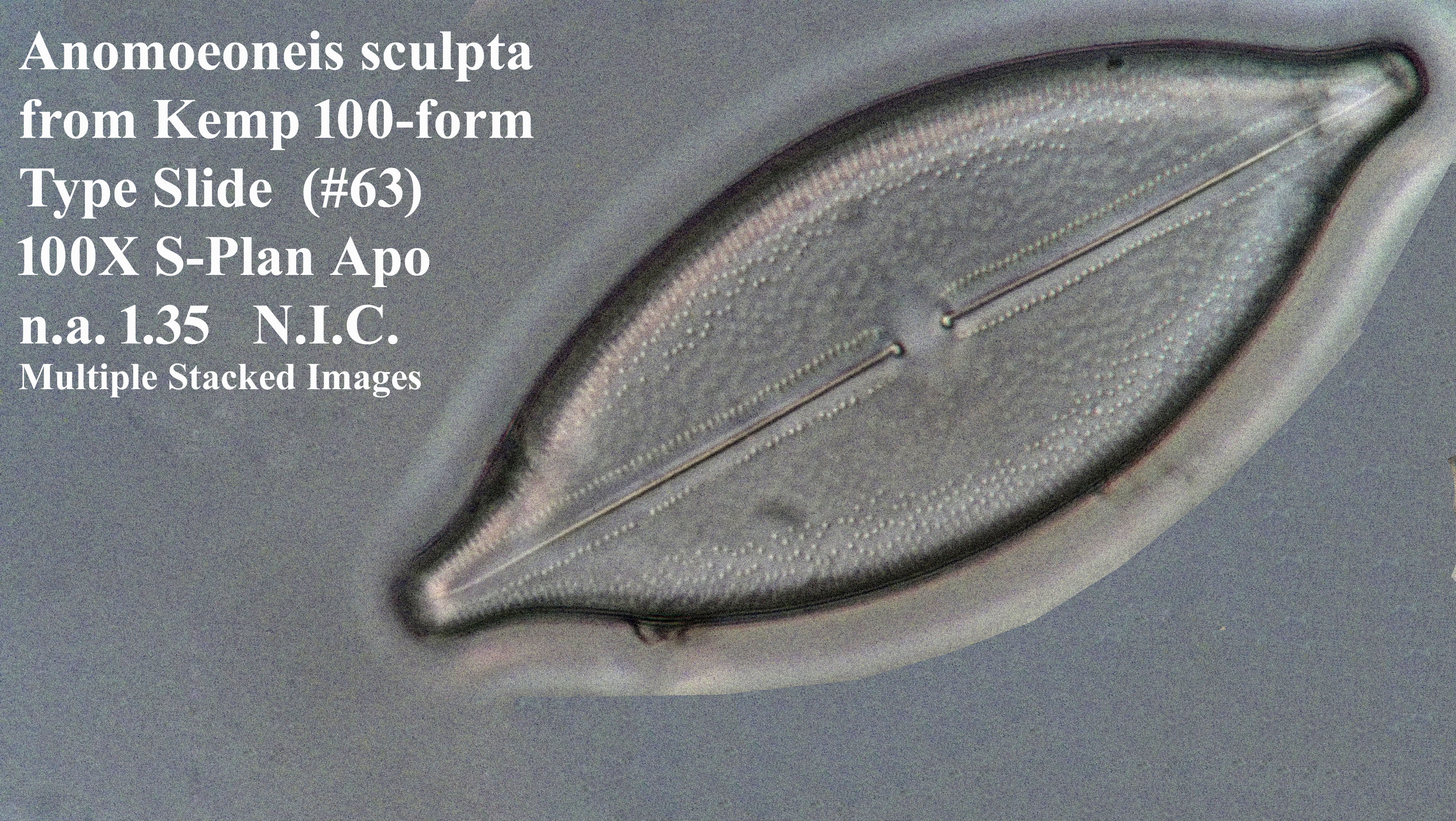 Anomoeonneis sculpta