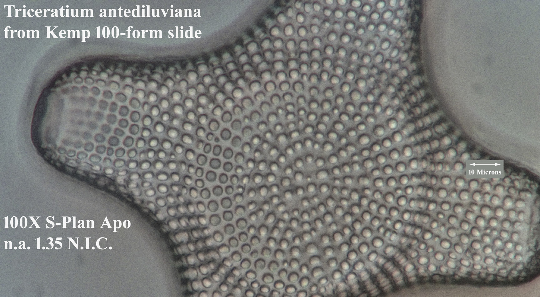 Triceratium antidiluviana