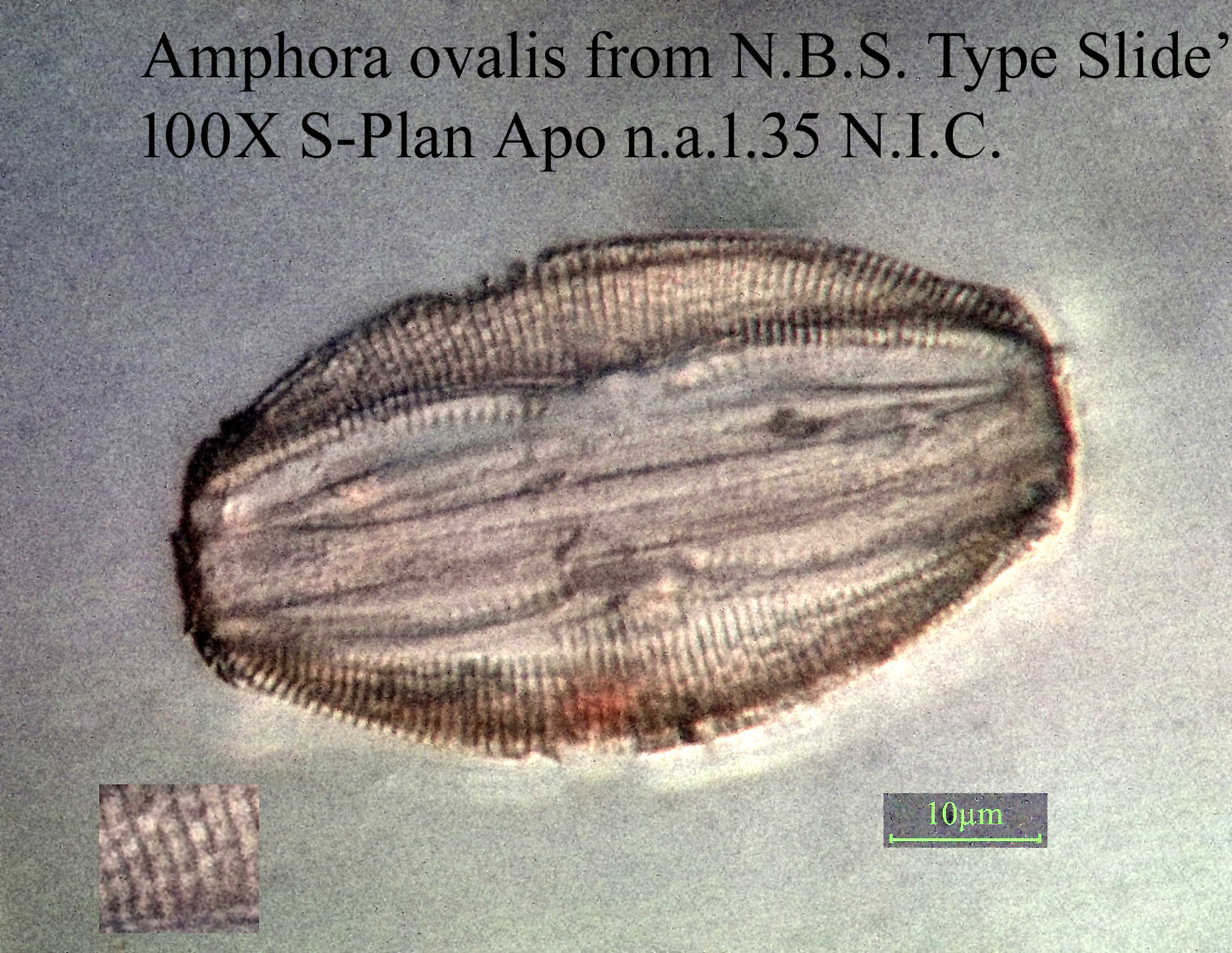 diatom