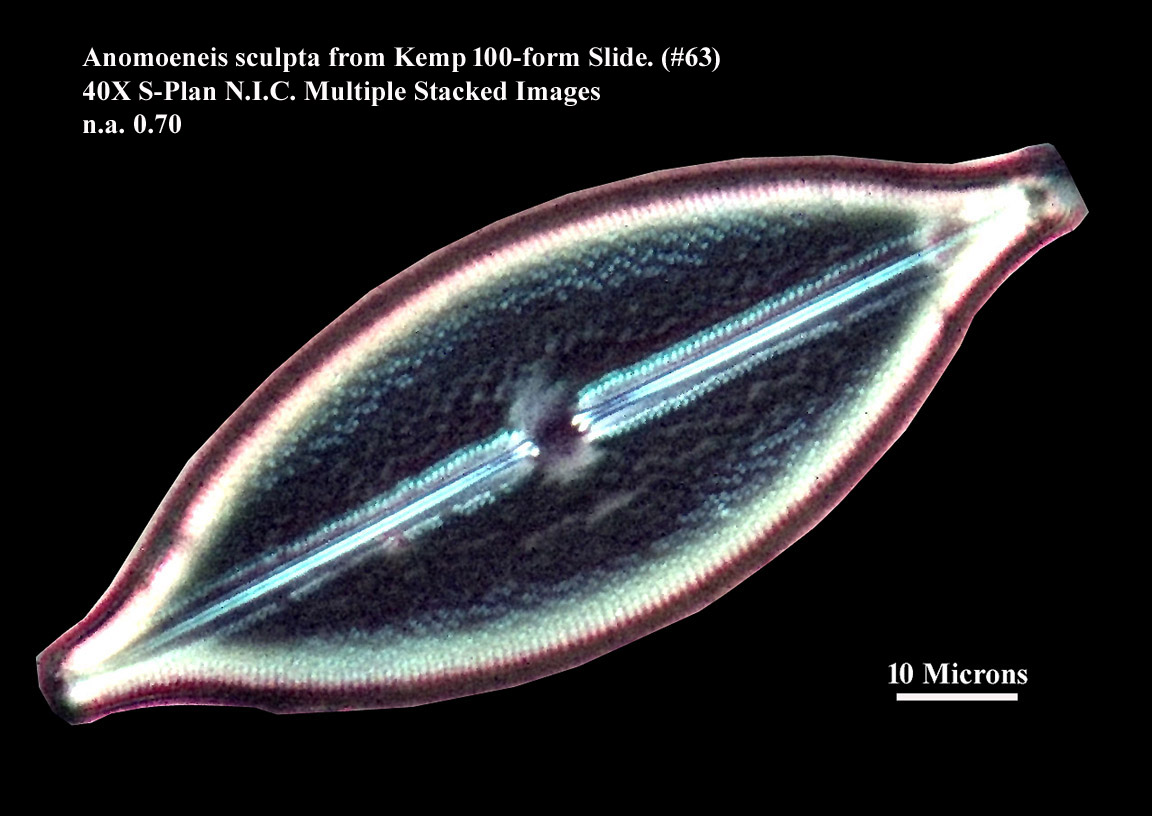 Anomoeonneis sculpta