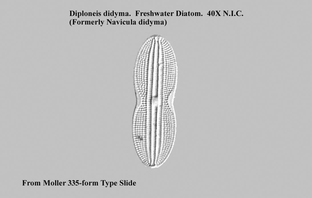 diatom