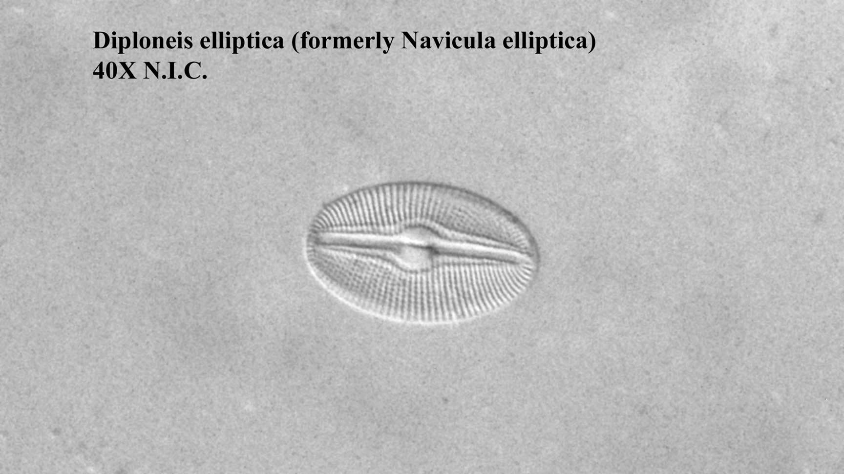 Diatom