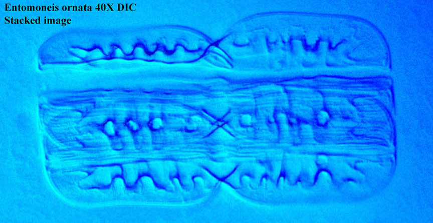 diatom