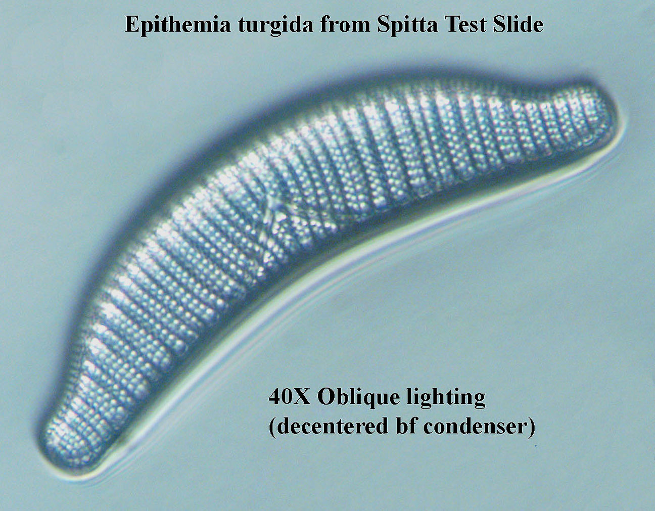 Epithemia turgida