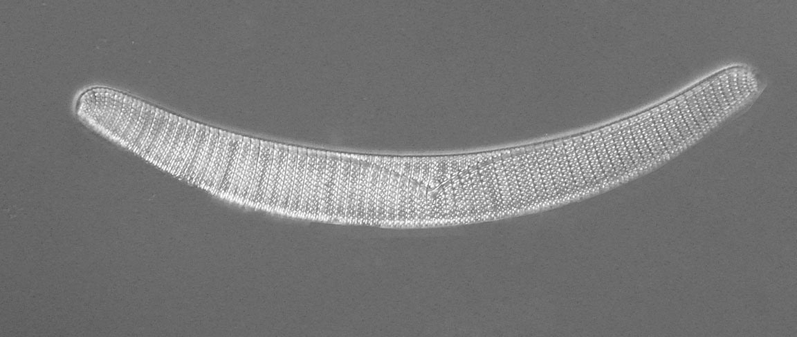 diatom