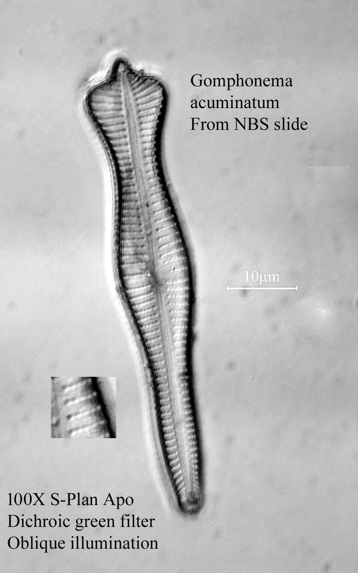 diatom