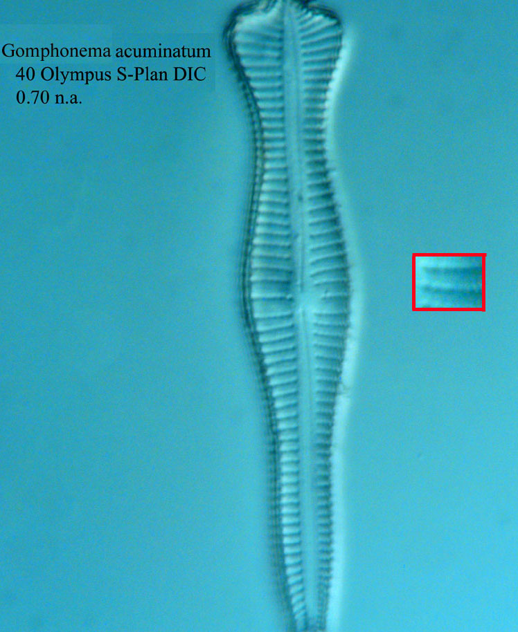 diatom