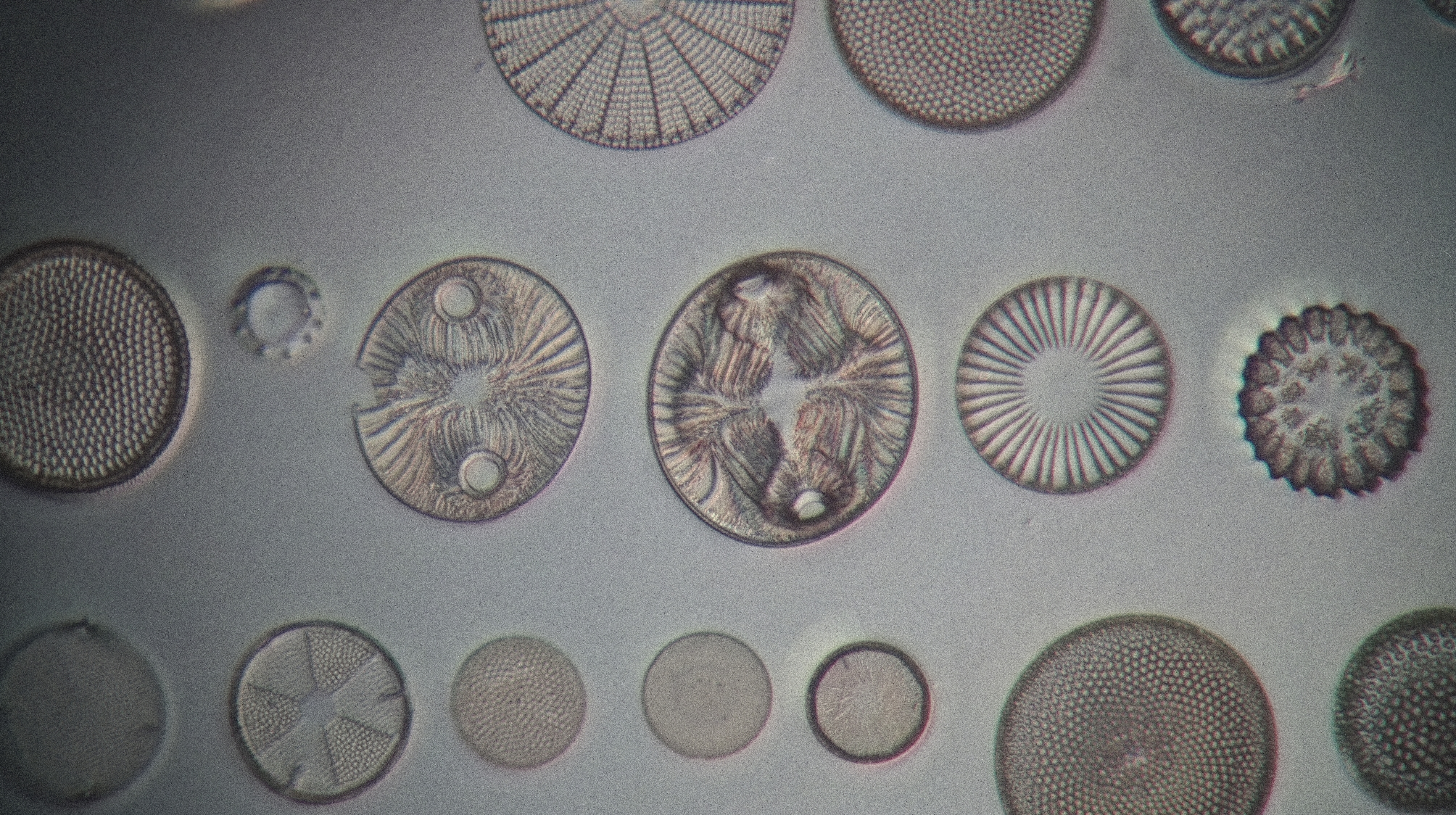 diatom