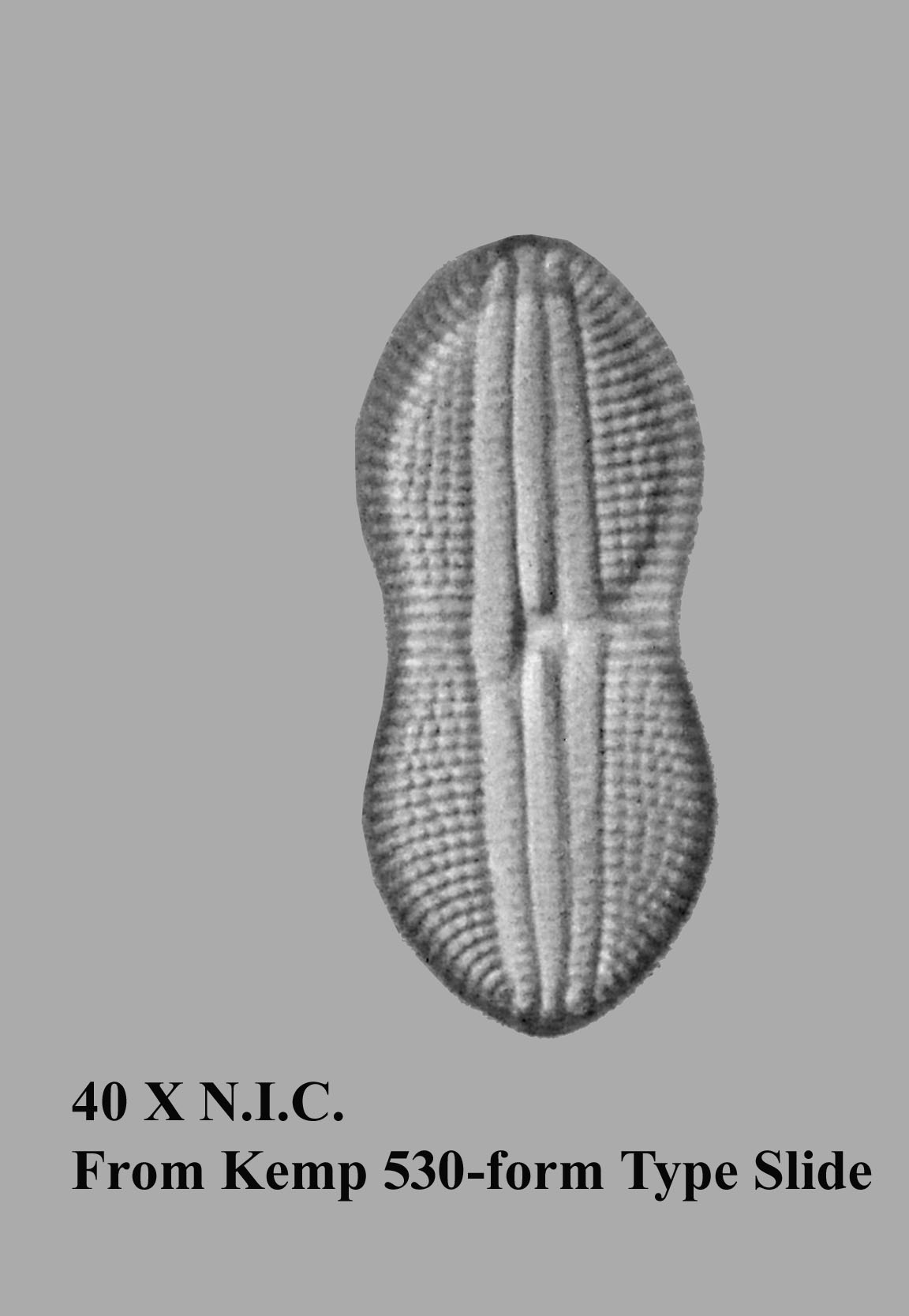 diatom