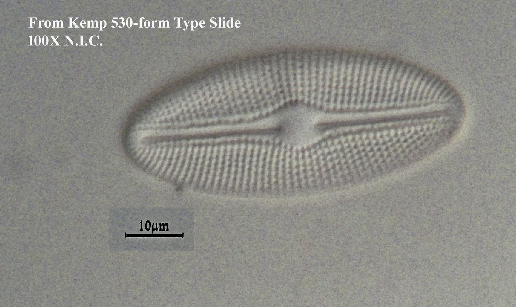 diatom