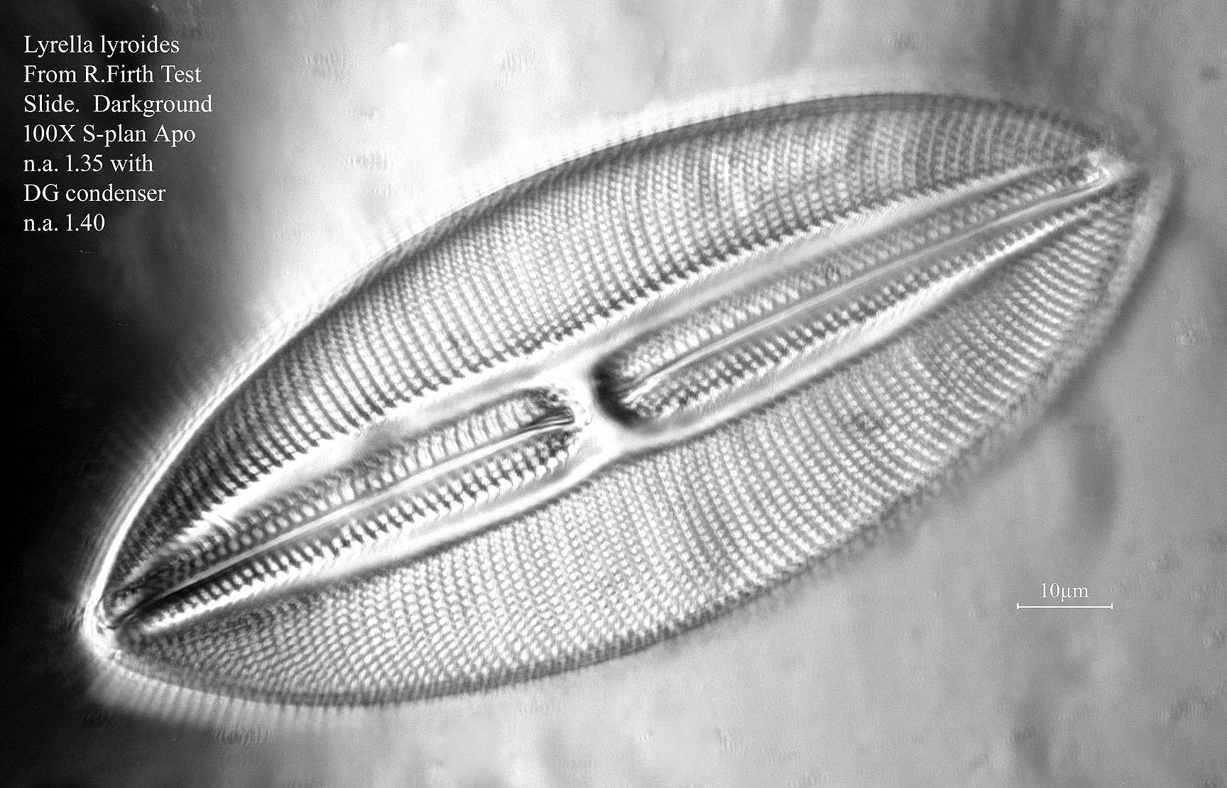 diatom