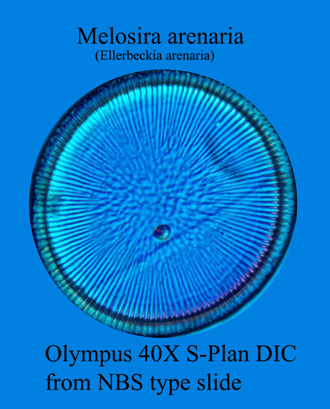 diatom