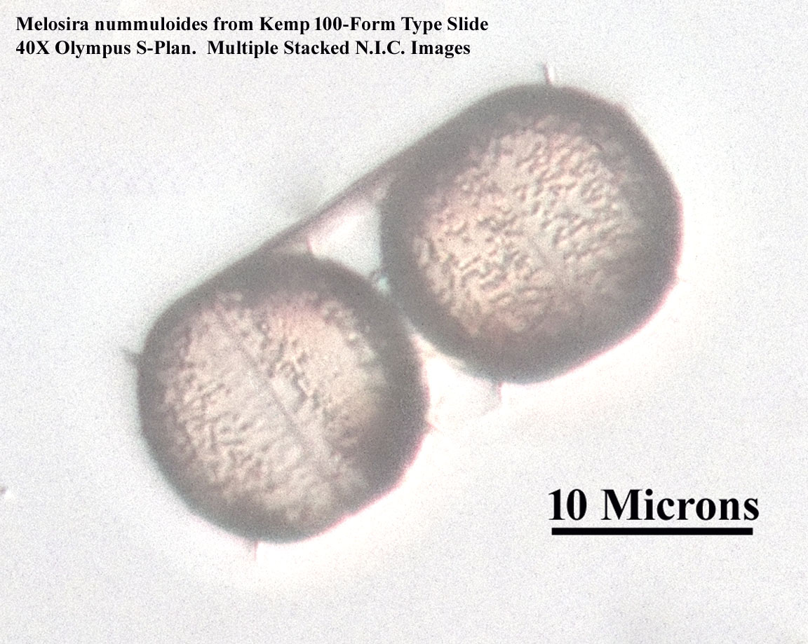 Melosira nummuloides