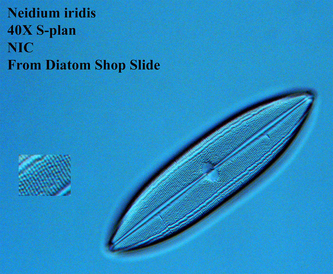 diatom