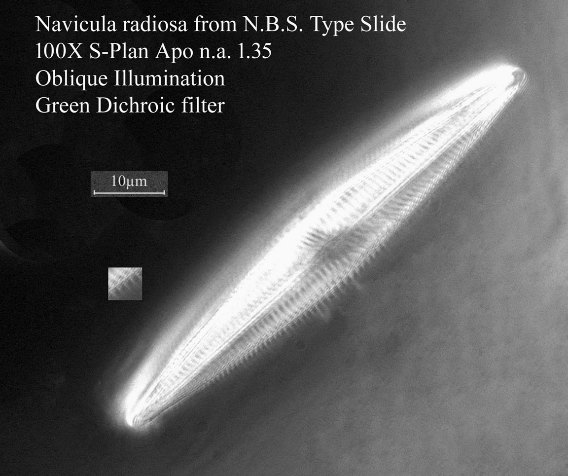 diatom