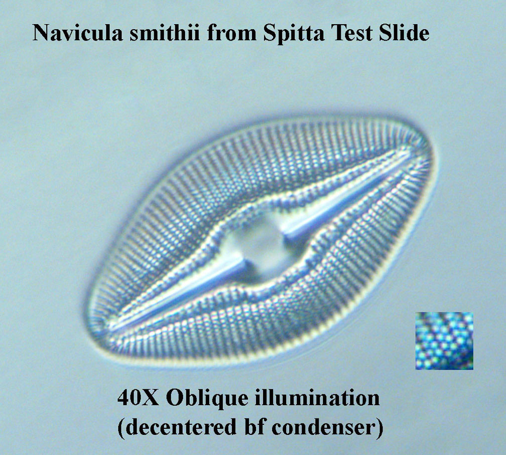 N. smithii oblique illumination