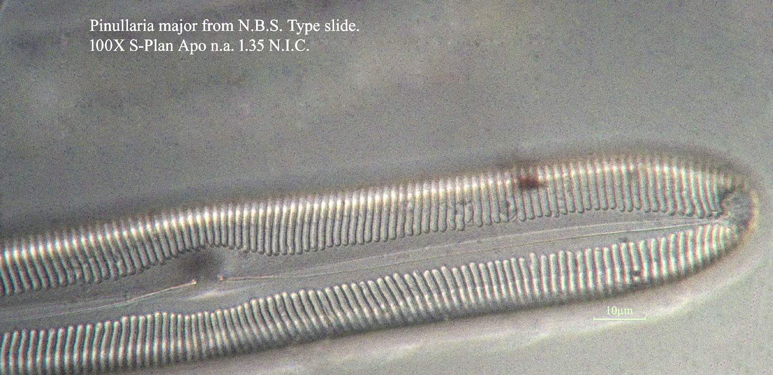 diatom