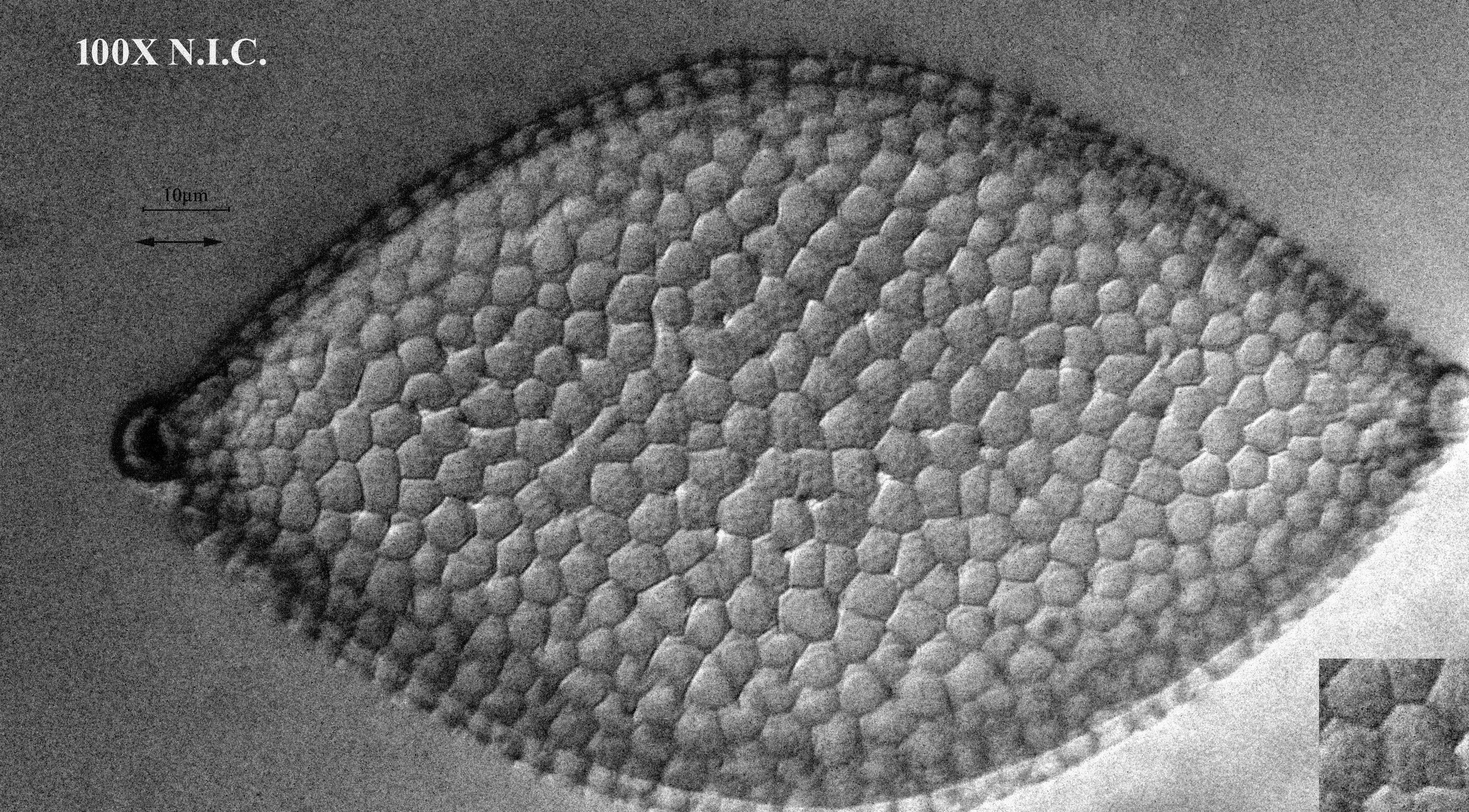 diatom