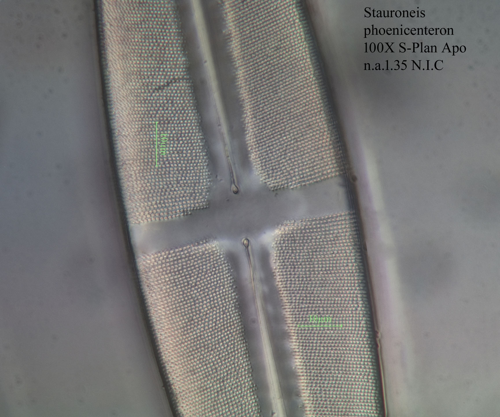 diatom