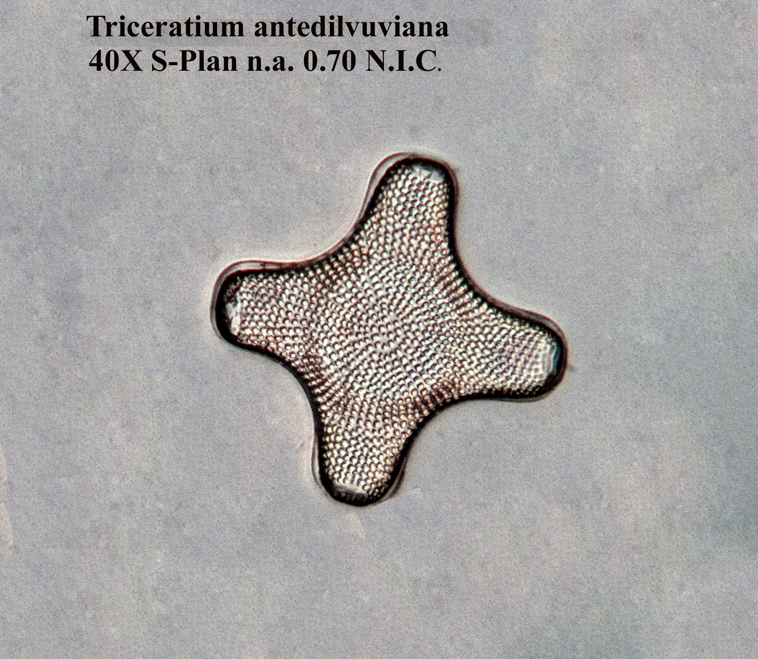 Triceratium antidiluviana