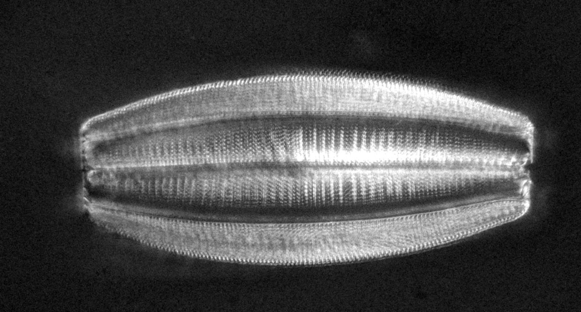 diatom