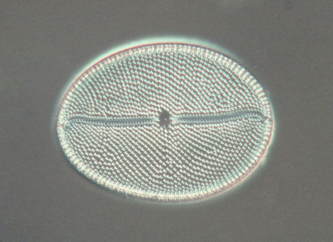 diatom