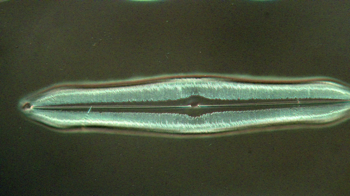 diatom