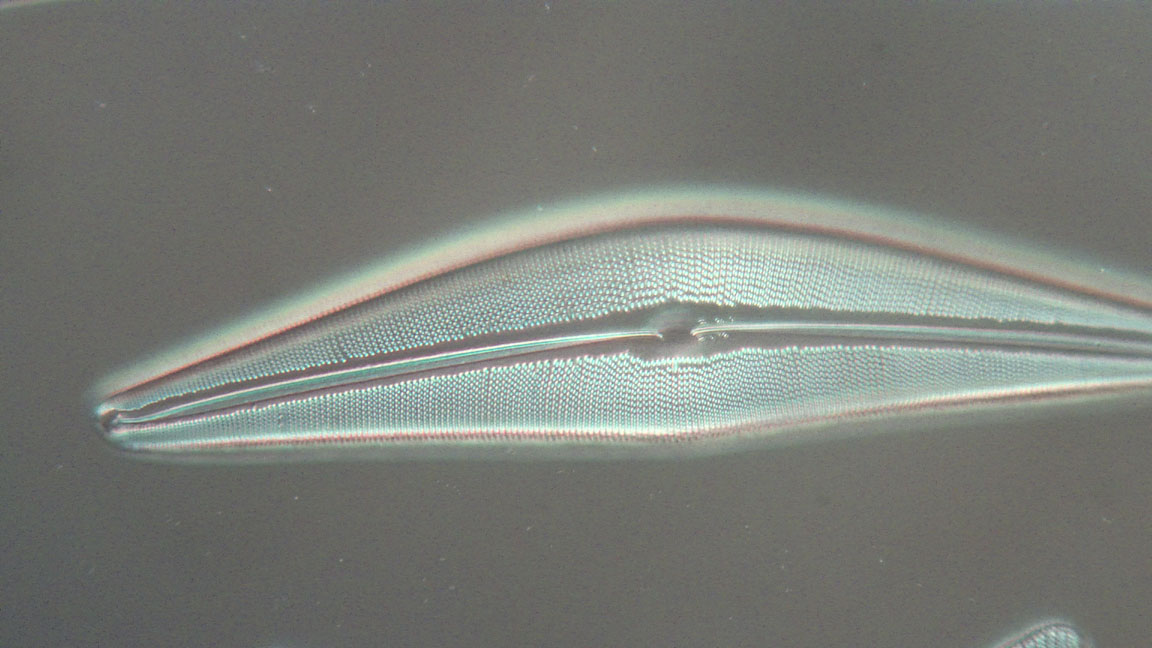 diatom