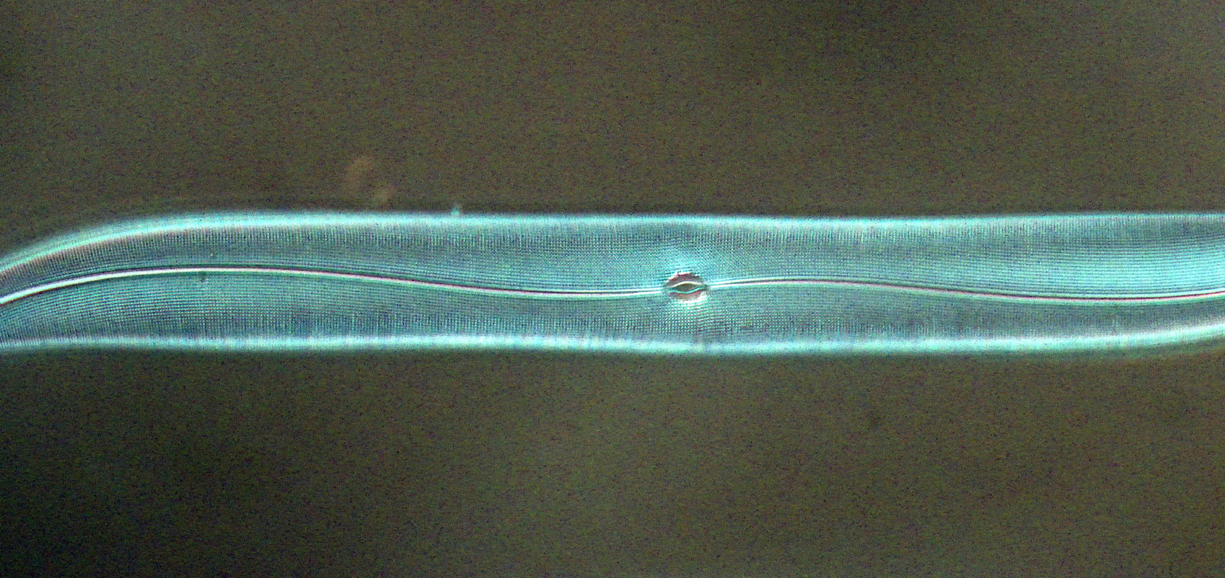diatom